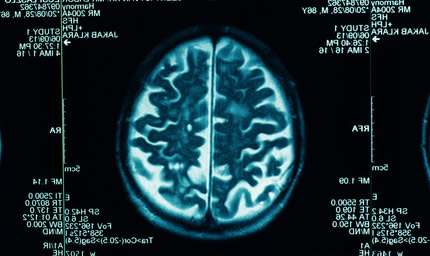 プロスト法律事務所の弁護士だから出来る、遷延性意識障害の解決
